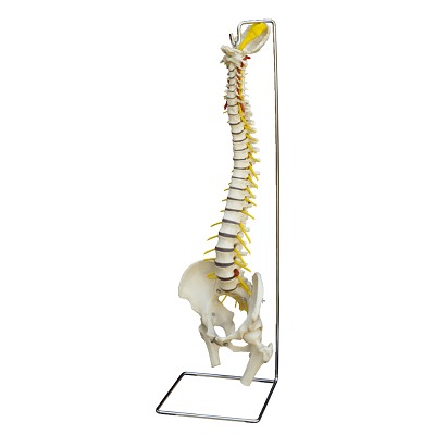Anatomisch model "Wirbelsäule mit Bandscheibenvorfall
